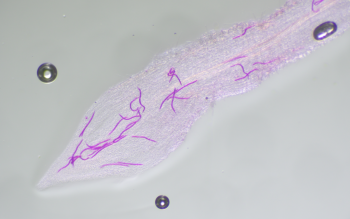 nematode_infection